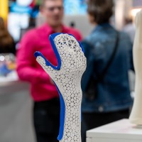 Modern gestaltete Handorthese mit 3D-gedrucktem Wabenmuster und blauen Akzenten ausgestellt auf der OTWorld, im Hintergrund Messebesucher im Gespräch Modern gestaltete Handorthese mit 3D-gedrucktem Wabenmuster und blauen Akzenten ausgestellt auf der OTWorld, im Hintergrund Messebesucher im Gespräch