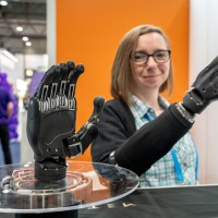 Eine Ausstellerin präsentiert stolz eine Hightech-Handprothese auf der OTWorld. Eine Ausstellerin präsentiert stolz eine Hightech-Handprothese auf der OTWorld.